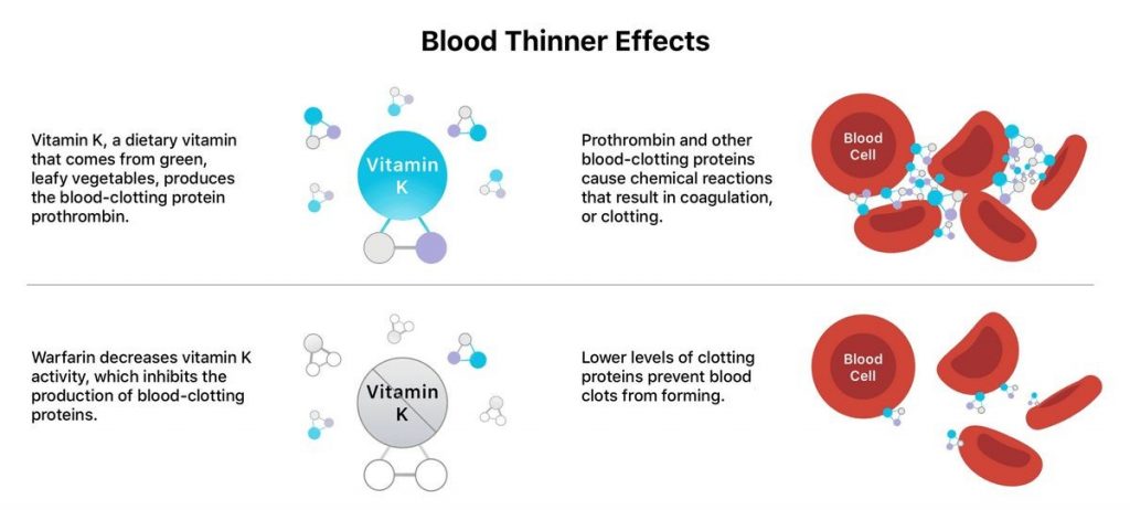 Plavix clopidogrel vs Coumadin warfarin Anti-clotting Medications