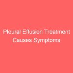 Pleural Effusion Treatment Causes Symptoms Prognosis