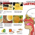 Reflux Laryngitis Causes Diet Home Remedies Medication