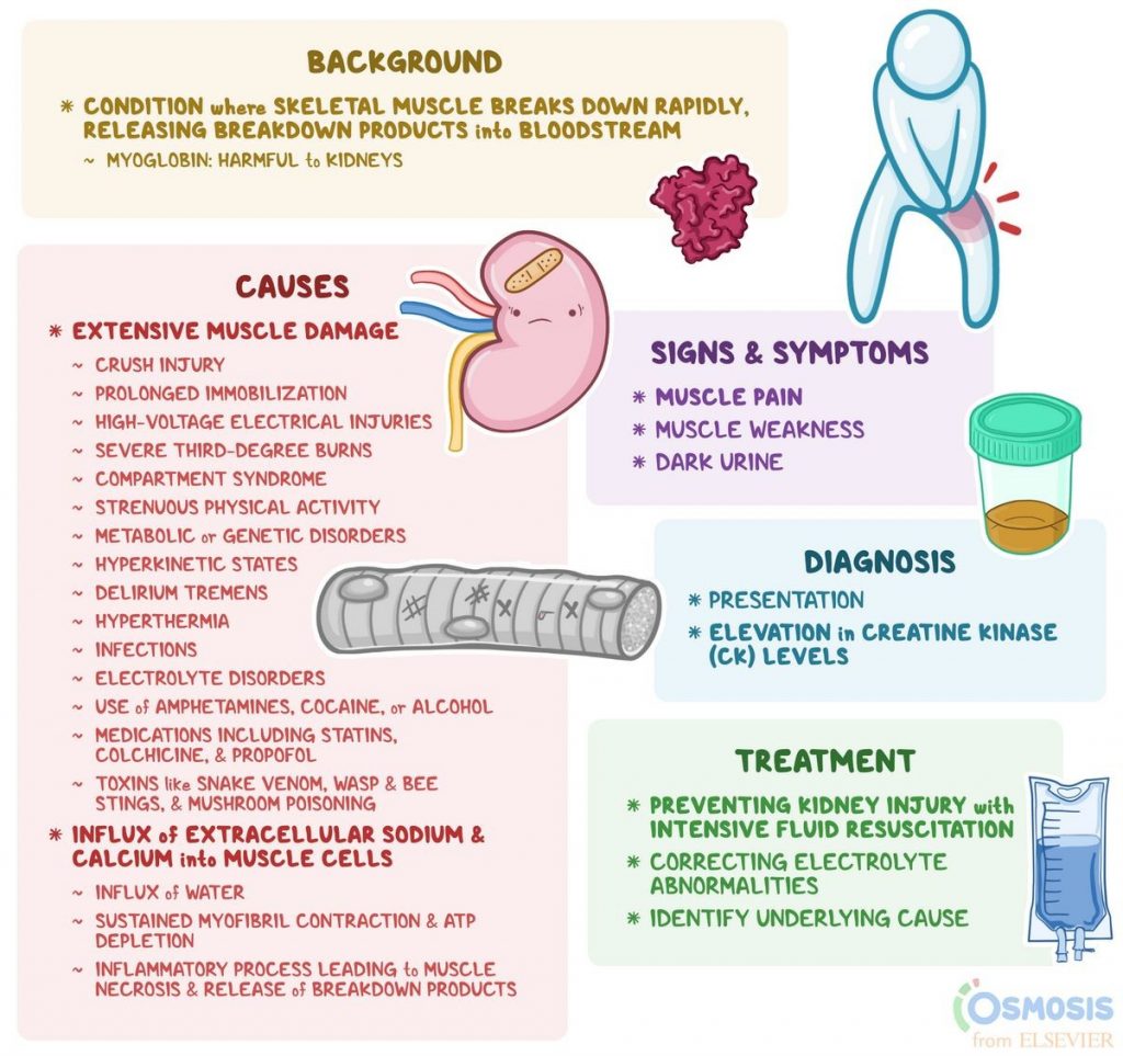 Rhabdomyolysis Symptoms Causes Diagnosis Recovery