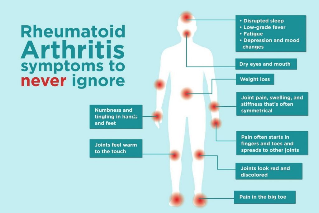 Rheumatoid Arthritis 17 Signs of Serious Complications