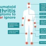 Rheumatoid Arthritis 17 Signs of Serious Complications