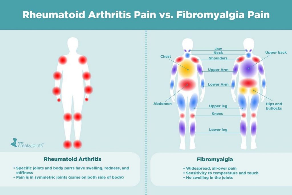 Rheumatoid Arthritis vs Polymyalgia Rheumatica Chart Causes Treatment