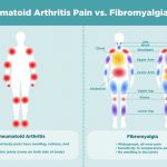 Rheumatoid Arthritis vs Polymyalgia Rheumatica Chart Causes Treatment
