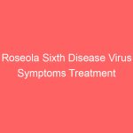 Roseola Sixth Disease Virus Symptoms Treatment Causes