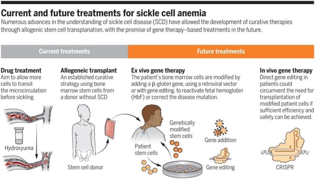 Sickle Cell Disease Anemia Symptoms Treatment and Life Expectancy