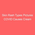 Skin Rash Types Pictures COVID Causes Cream Treatment