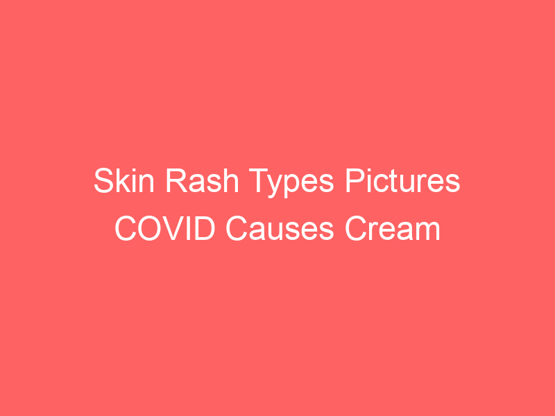 Skin Rash Types Pictures COVID Causes Cream Treatment