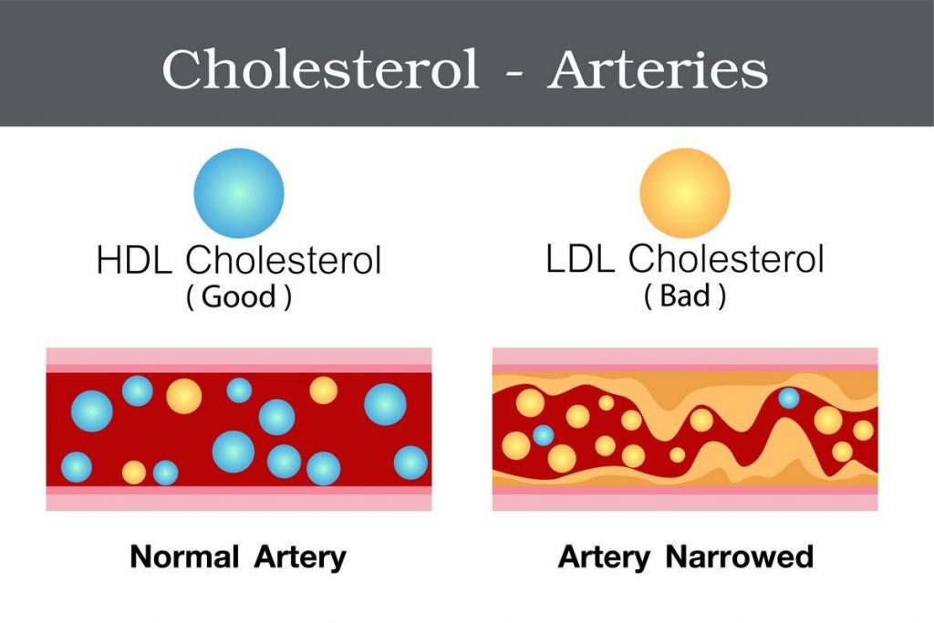 Statins – Doing More Than Lowering Your Cholesterol