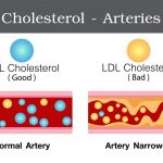 Statins – Doing More Than Lowering Your Cholesterol