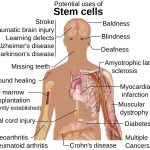 Stem Cells Therapy Function Treatment Uses