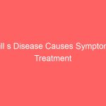 Still s Disease Causes Symptoms Treatment Medications Prevention