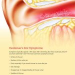 Swimmer s Ear Causes Symptoms Drops Treatment Pain Relief