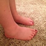 Swollen Ankles and Feet How to Reduce Swelling Signs Causes When to Be Concerned