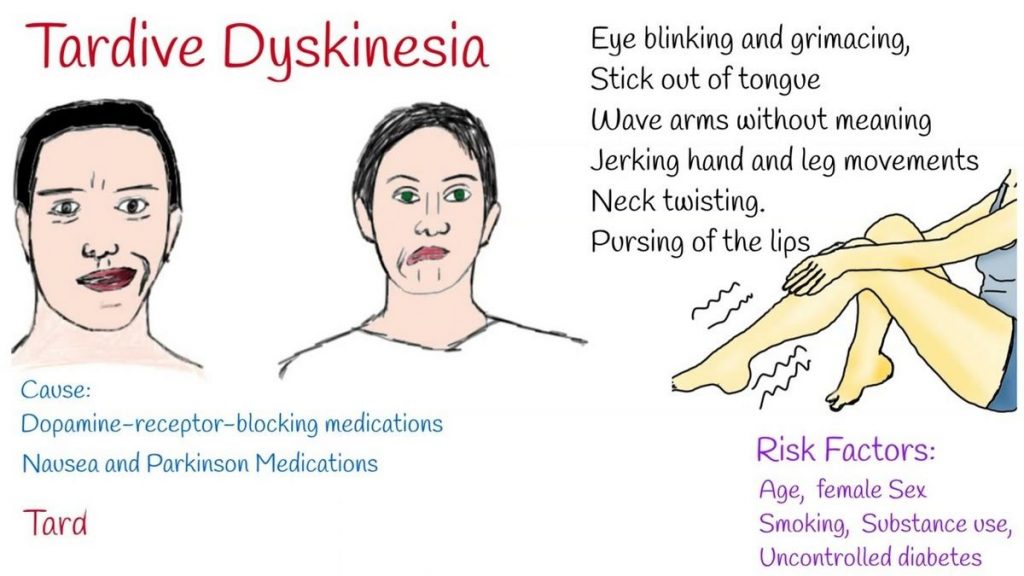 Tardive Dyskinesia Symptoms Treatment Medication Causes