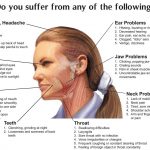 Temporomandibular Joint Syndrome TMJ Symptoms Treatment