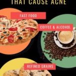 Top 12 Foods That Can Cause Acne Foods to Avoid Acne Causes