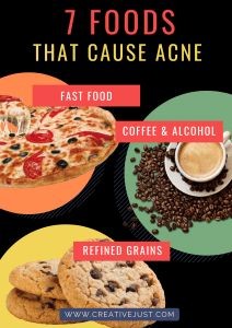 Top 12 Foods That Can Cause Acne Foods to Avoid Acne Causes