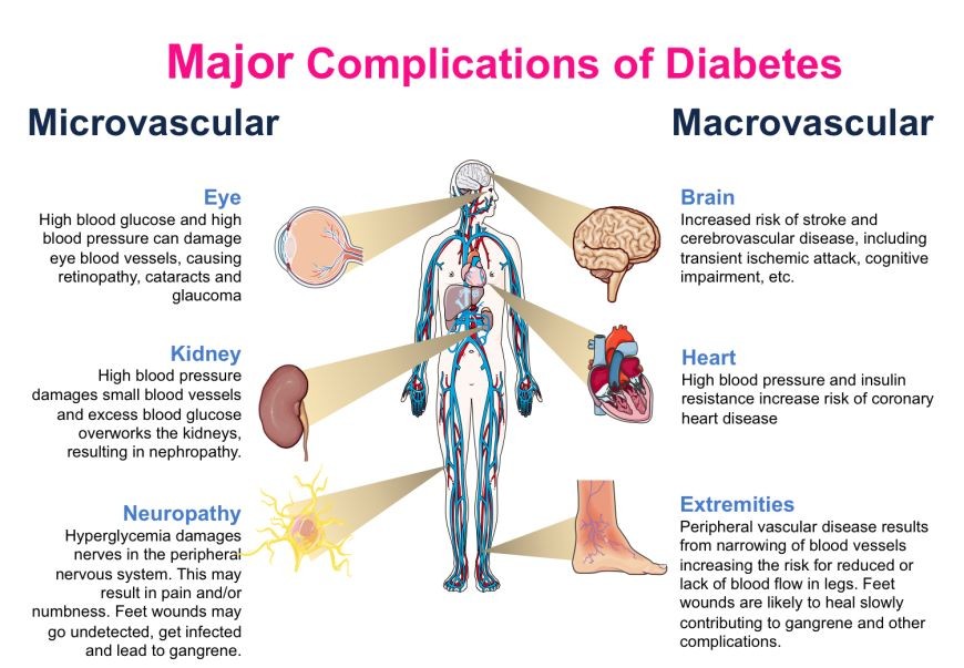 What Are Complications of Uncontrolled Diabetes