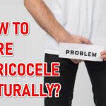 What Are the 5 Signs of a Varicocele Symptoms Causes Treatment