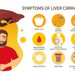 What Are the First Signs of Cirrhosis Symptoms Causes Treatment