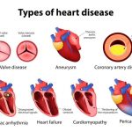 What Are the Four Main Functions of the Heart Common Heart Diseases