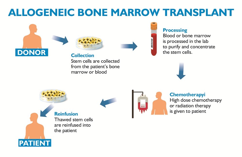 What are the Risks or Complications of a Bone Marrow Procedure