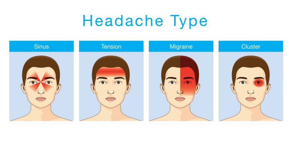 What Are the Types of Migraine Headache Medications