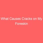 What Causes Cracks on My Foreskin