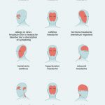 What Causes Headaches at the Back of the Head 6 Main Types