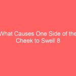 What Causes One Side of the Cheek to Swell 8 Causes