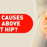 What Causes Pain on the Left Side Above the Hip