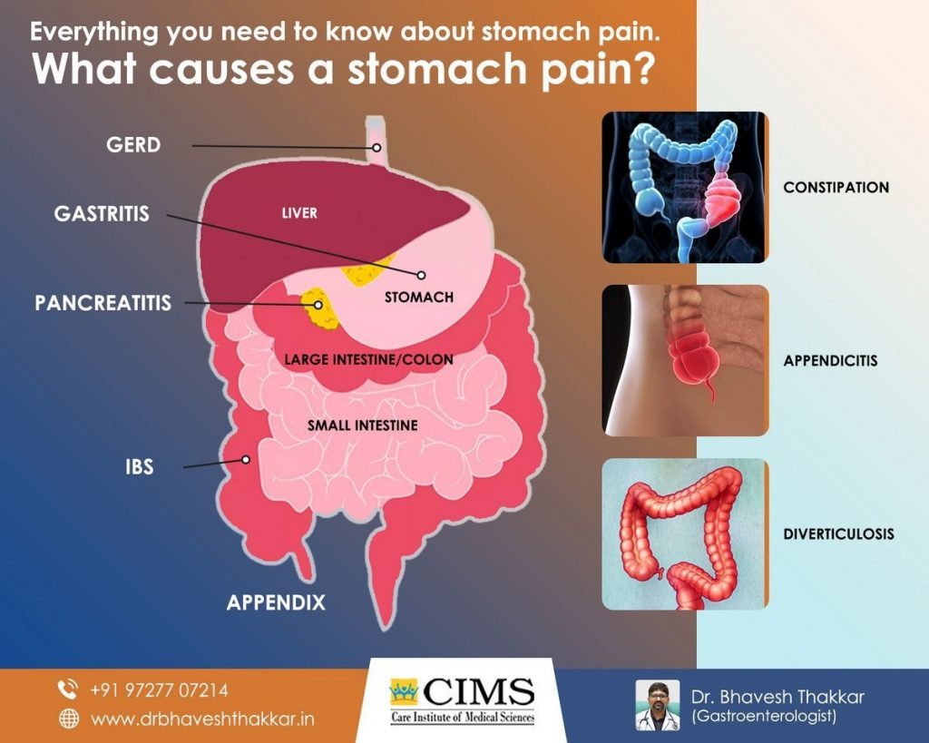 What Causes Stomach Pain in Girls 20 Possible Causes