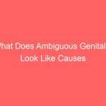 What Does Ambiguous Genitalia Look Like Causes Treatment