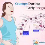 What Does Early Pregnancy Cramping Feel Like