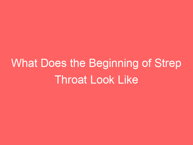 What Does the Beginning of Strep Throat Look Like Infection Symptoms