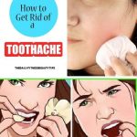 What Gets Rid of Toothache Instantly 19 Simple Methods