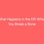 What Happens in the ER When You Break a Bone Urgent Care