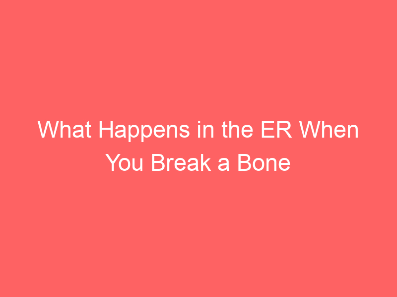 What Happens in the ER When You Break a Bone Urgent Care