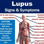 What Happens When You Have Lupus 12 Symptoms Types Causes