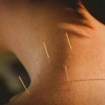 What Is Acupuncture Used For Benefits Points Needles