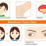 What Is Botulinum Toxin Used For