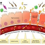 What Is the Main Cause of Leaky Gut and How Do You Fix It