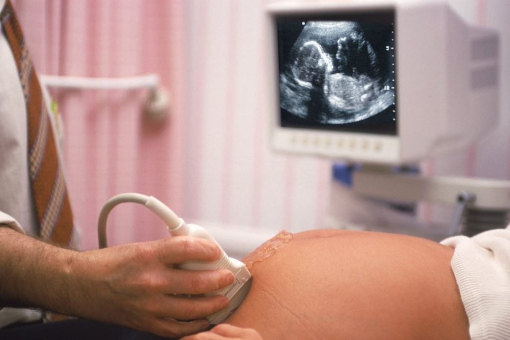 When Do You Need a Target Scan While Pregnant 3 Objectives