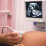 When Do You Need a Target Scan While Pregnant 3 Objectives