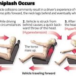 Whiplash Injury Symptoms Diagnosis Treatment