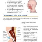 Why Would A Child Need A Tracheostomy