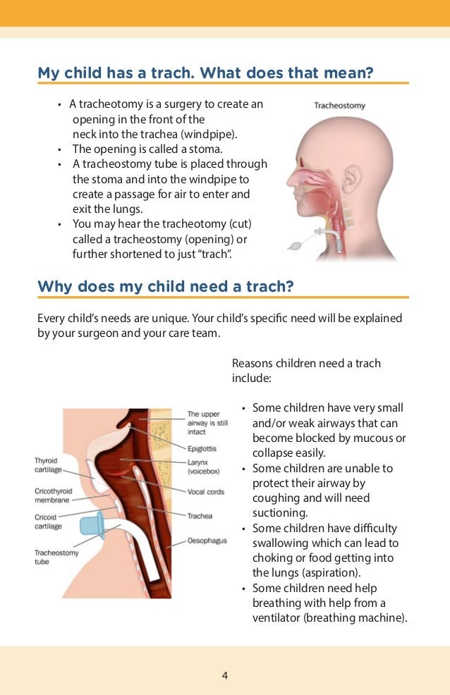 Why Would A Child Need A Tracheostomy