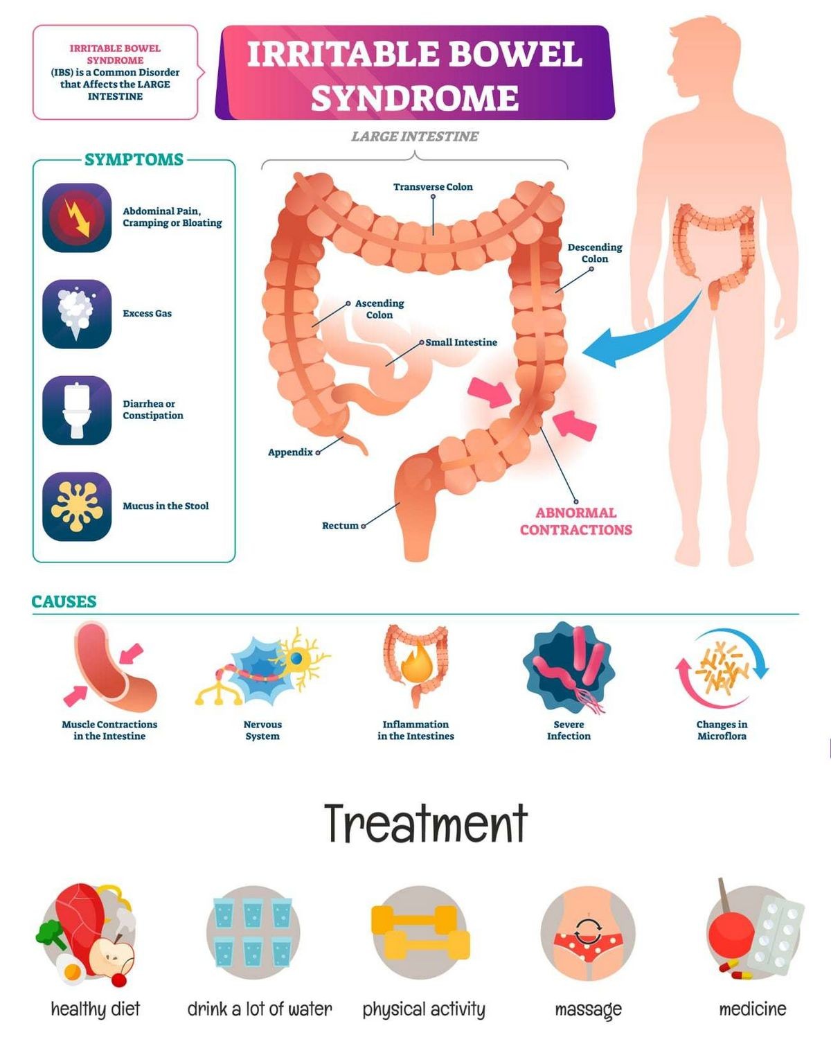 Irritable Bowel Syndrome IBS Quiz Answer Top Questions