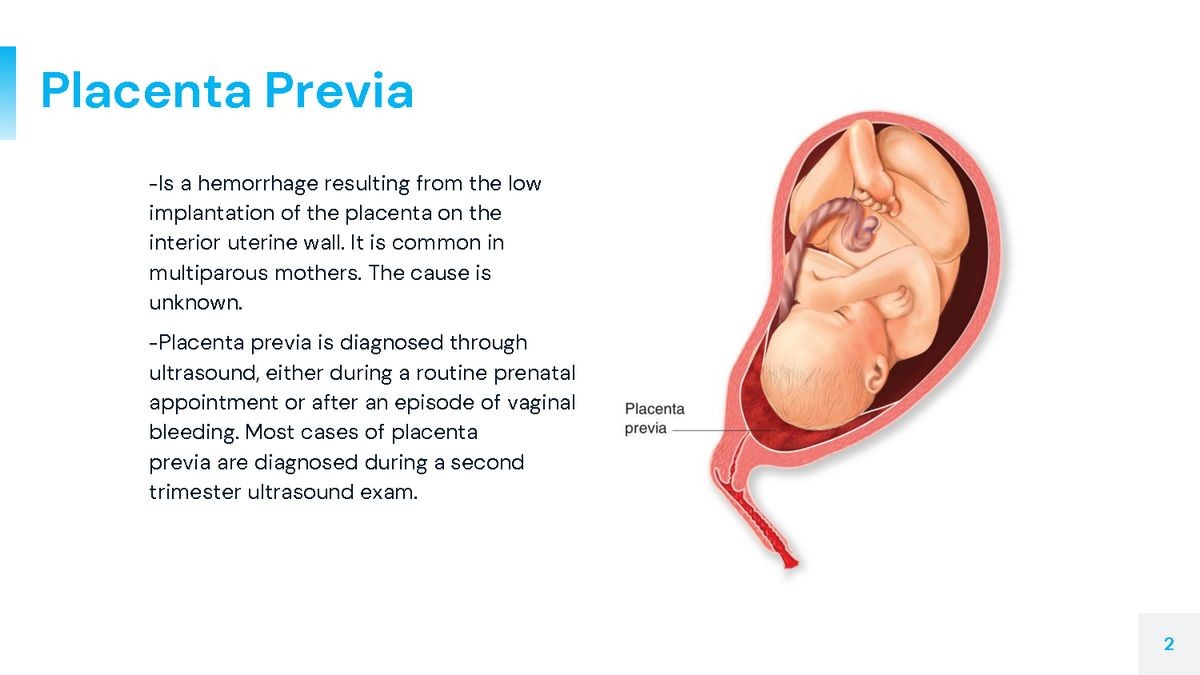 Placenta Previa Symptoms Types Causes Risks Treatment
